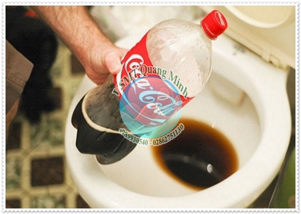 Tại sao bồn cầu ph&aacute;t ra tiếng k&ecirc;u ộc ộc